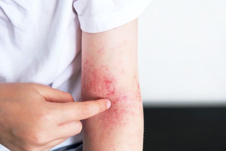 Is Pen Ink Bad for Your Skin? Writing on Your Skin With Pen